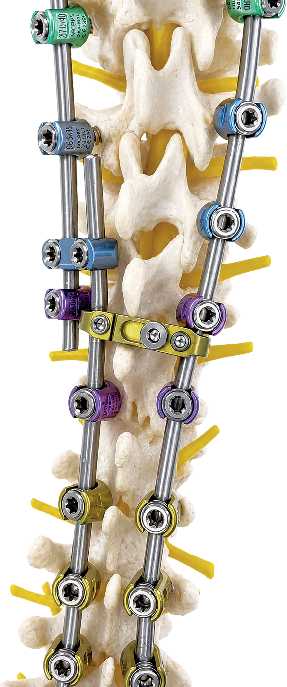 Lumbar — Medical Consept implants, catalogue image
